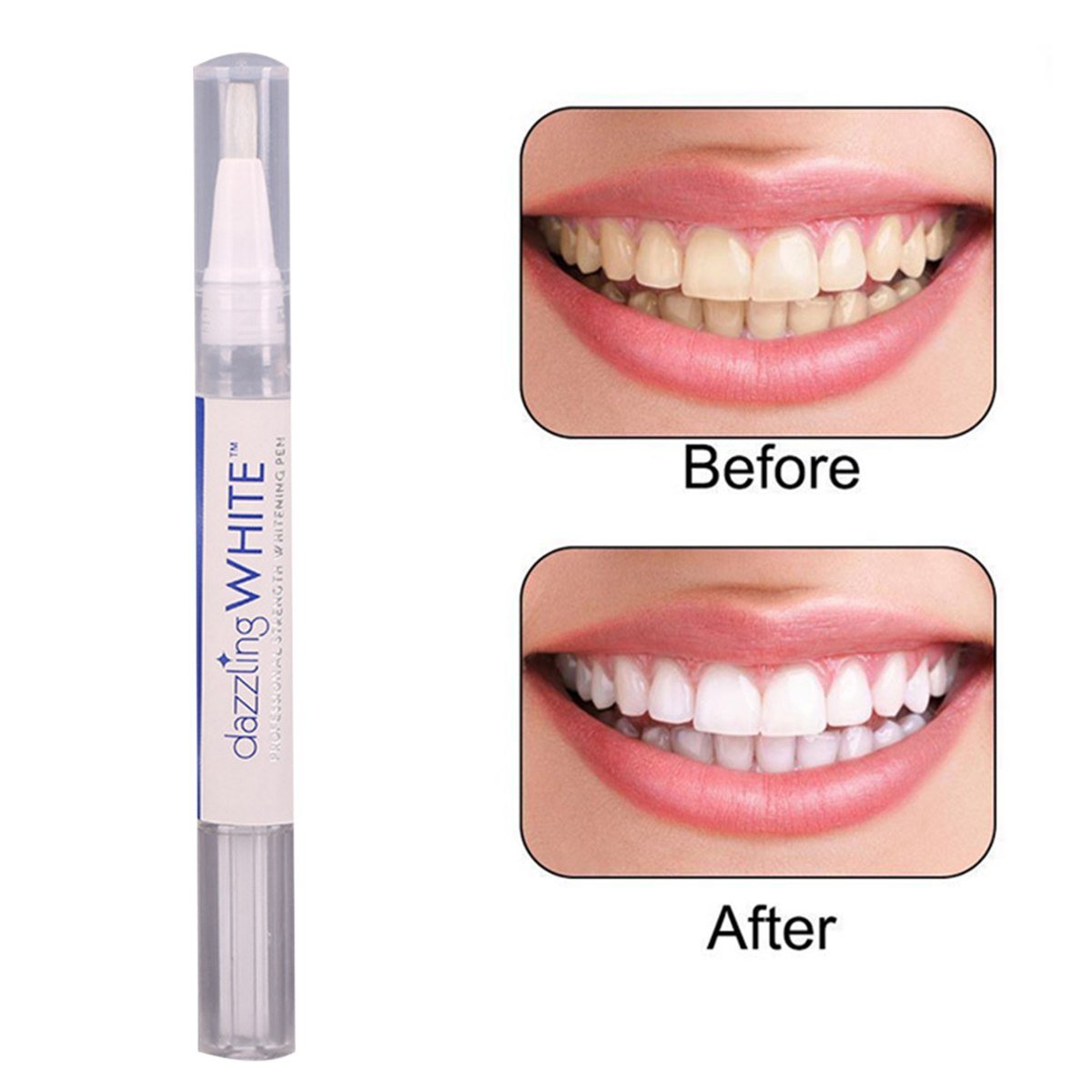 Dazzling Instant Teeth Whitening Pen