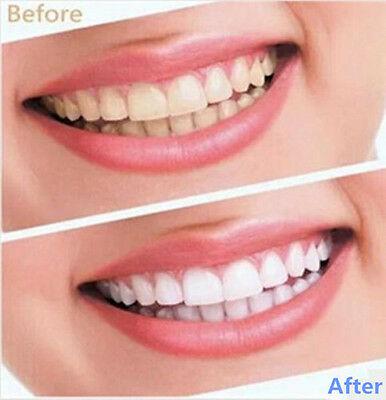 Dazzling Instant Teeth Whitening Pen
